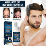 Kopfhautpflege-Haarwuchsspray