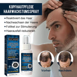 Kopfhautpflege-Haarwuchsspray